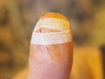 finger_steristrip.JPG finger_steristrip.JPG