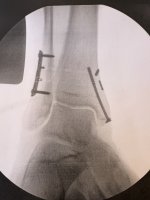 IMG_7755.jpeg IMG_7755.jpeg